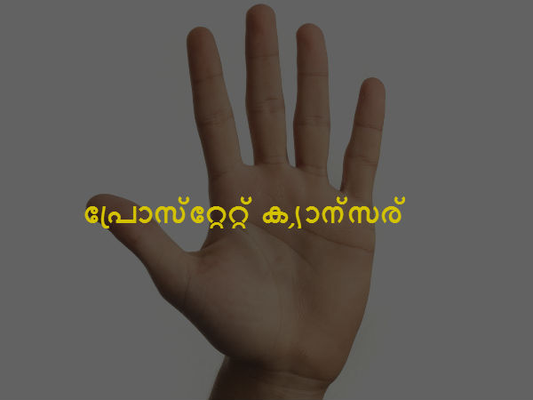 പ്രോസ്‌റ്റേറ്റ് ക്യാന്‍സര്‍