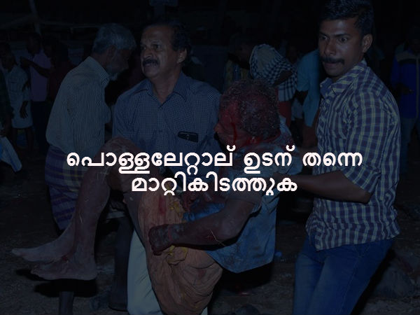 പൊള്ളലേറ്റാല്‍ ഉടന്‍ തന്നെ മാറ്റികിടത്തുക