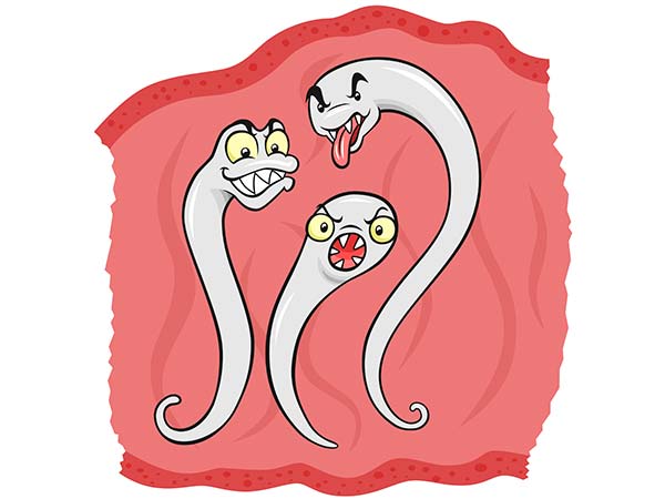  ആര്‍ത്രൈറ്റിസ്