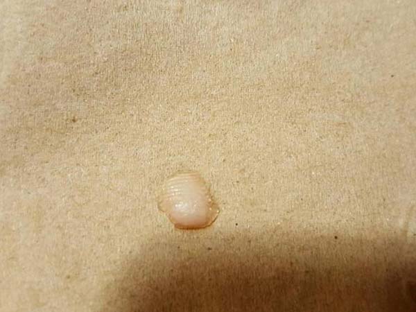  വിരലിന്റെ അറ്റം സൂപ്പില്‍ നിന്ന്