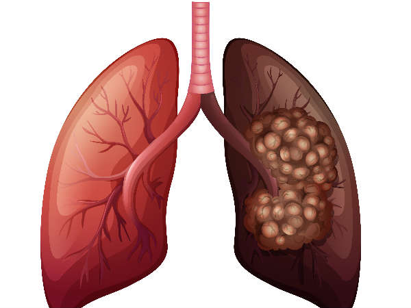 റേഡിയോ ആക്ടീവ് വികിരണങ്ങള്‍