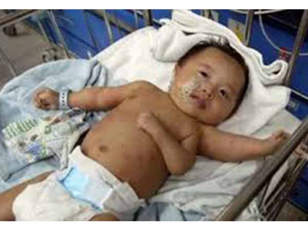 മൂന്ന് കൈയ്യുമായി അത്ഭുത ശിശു