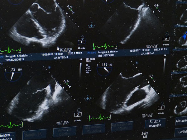 യൂട്രസ് കരയുന്നുവോ ചിരിയ്ക്കുന്നുവോ?