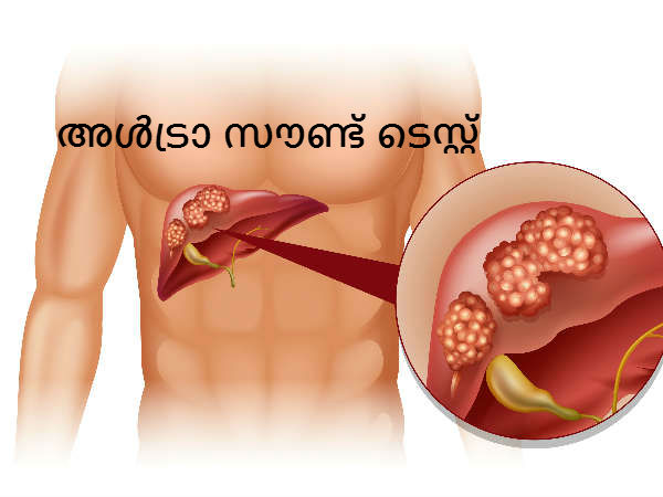 അള്‍ട്രാ സൗണ്ട് ടെസ്റ്റ്