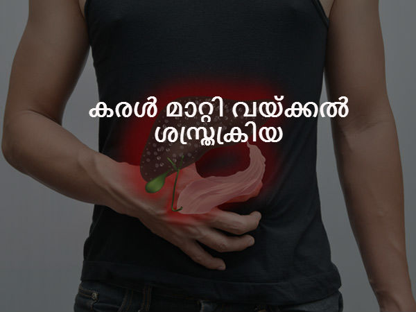 കരള്‍ മാറ്റി വയ്ക്കല്‍ ശസ്ത്രക്രിയ