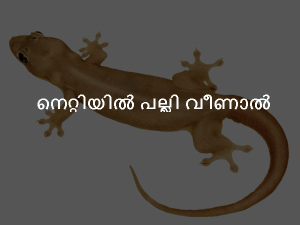 നെറ്റിയില് പല്ലി വീണാല് നെറ്റിയില് പല്ലി വീണാല്