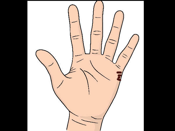 കൈരേഖ പറയും കല്യാണപ്രായം