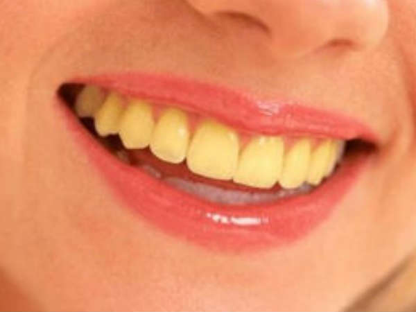 Whiten Your Teeth In Just 2 Minutes With This Home Remedy