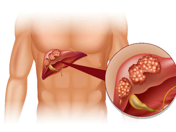 This Drink Will Destroy Your Bones From The Inside