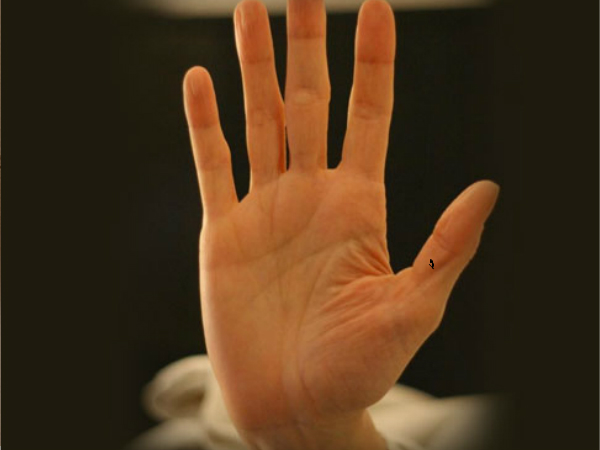 മറുകു പറയും സെക്‌സ് രഹസ്യങ്ങള്‍