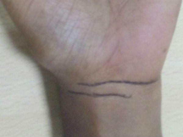 ബ്രേസ്ലറ്റ് ലൈന്‍ 2 ആണെങ്കില്‍