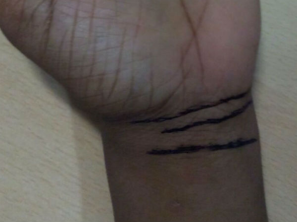 ബ്രേസ്ലറ്റ് ലൈന്‍ 3 ആണെങ്കില്‍