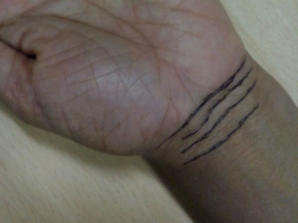  ബ്രേസ്ലറ്റ് ലൈന്‍ 4 ആണെങ്കില്‍