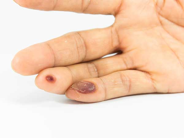 സെക്‌സിനിടെ മരണപ്പെട്ടവര്‍