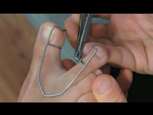  അസുഖങ്ങള്‍ക്ക് കാരണം കാല്‍ വിരല്‍