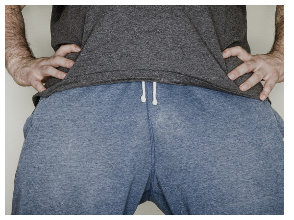 വൃഷണങ്ങളിലെ ചൊറിച്ചില്‍, പരിഹാരം...