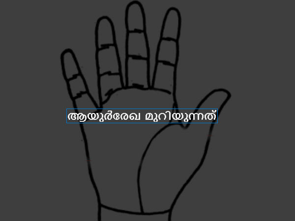  ആയുര്‍രേഖ മുറിയുന്നത്