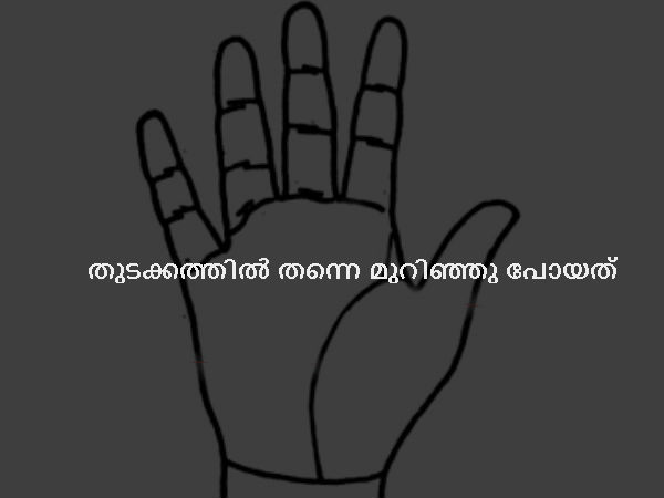  തുടക്കത്തില്‍ തന്നെ മുറിഞ്ഞു പോയത്