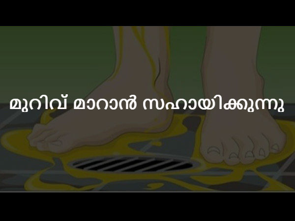 മുറിവ് മാറാന്‍ സഹായിക്കുന്നു