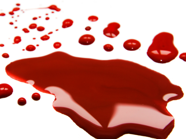 കന്യകാത്വം തെളിയിക്കാന്‍ പെടാപ്പാടുകള്‍