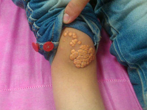 ചര്‍മ്മ പ്രശ്‌നങ്ങള്‍