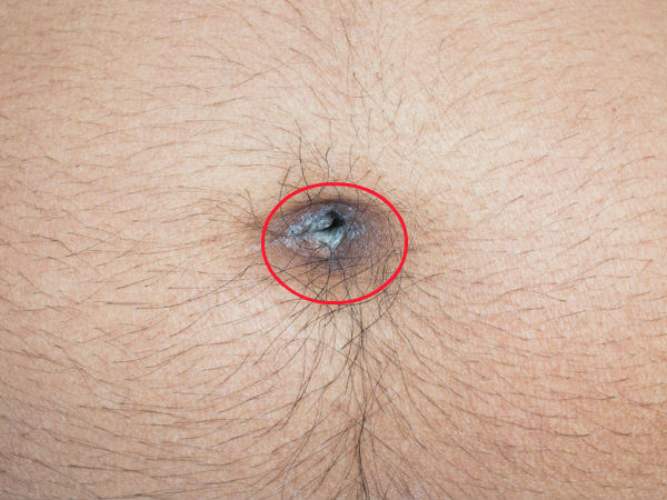 ദുര്‍ഗന്ധം പ്രശ്‌നമാകുമ്പോള്‍