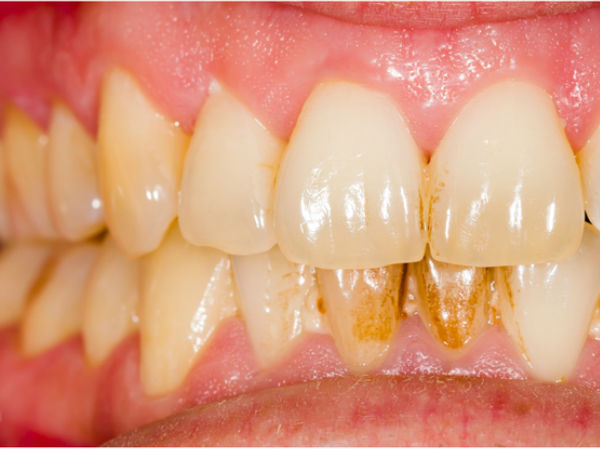 മറ്റ് പ്രശ്‌നങ്ങള്‍