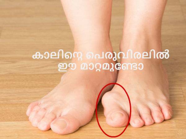 കാലിന്റെ പെരുവിരലില്‍ ഈ മാറ്റമുണ്ടോ?