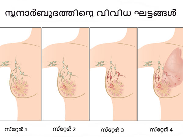 എല്ലാം ക്യാന്‍സര്‍ ലക്ഷണമല്ല