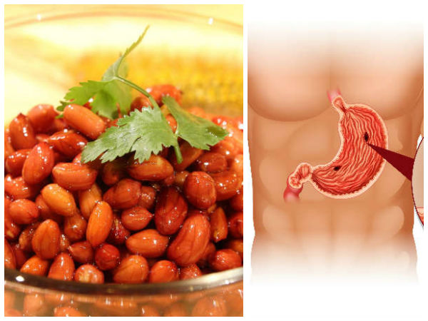 വയറ്റിലെ ക്യാന്‍സര്‍