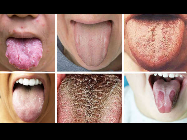  നാവിന്റെ നിറവും രോഗവും