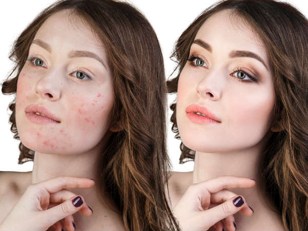 മുഖത്തെ അഴുക്കുകള് നീക്കാന് മുഖത്തെ അഴുക്കുകള് നീക്കാന്