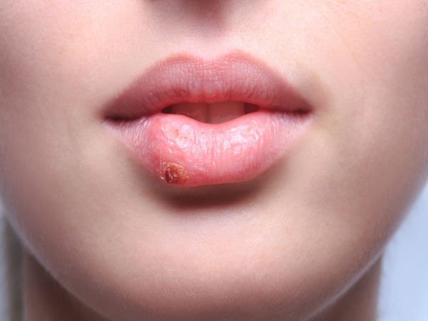 പവിഴാധാരം 