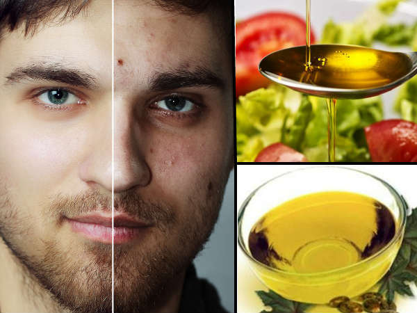 മുഖത്തെ സുഷിരങ്ങള്‍