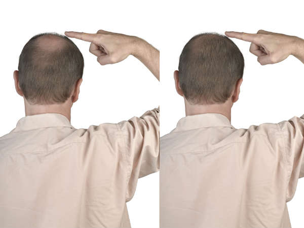  വൈറ്റമിനുകള്‍