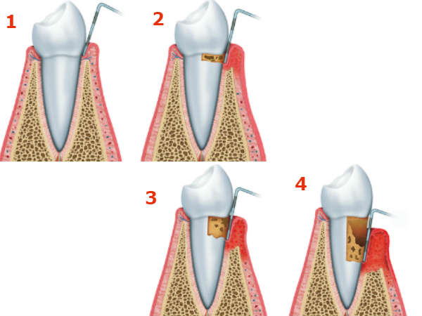എന്തുകൊണ്ട് ഇങ്ങനെ വരുന്നു?