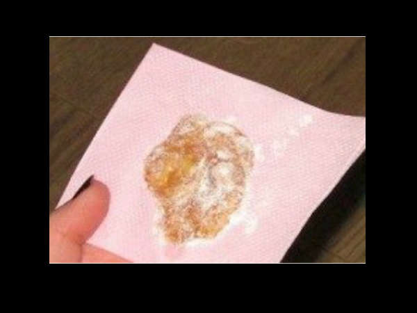 നെഞ്ചില്‍ ഇഞ്ചി ഇങ്ങനെ വയ്ക്കൂ, ഉണരുമ്പോള്‍