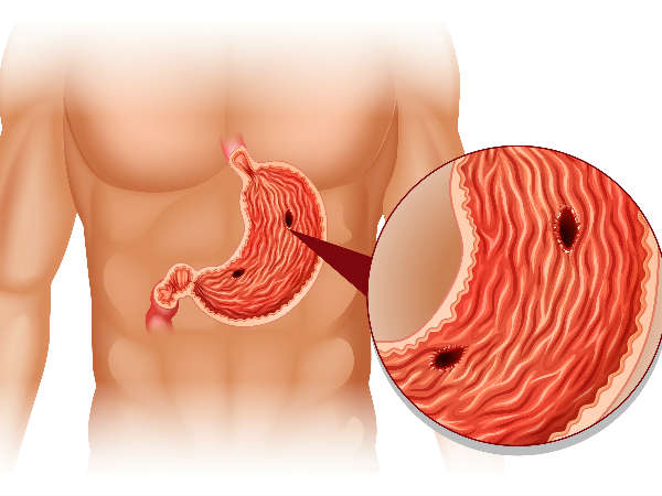  ക്യാന്‍സര്‍ തോല്‍ക്കുന്നു