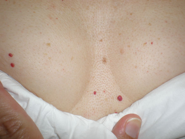 പുകവലി ഉപേക്ഷിക്കുക