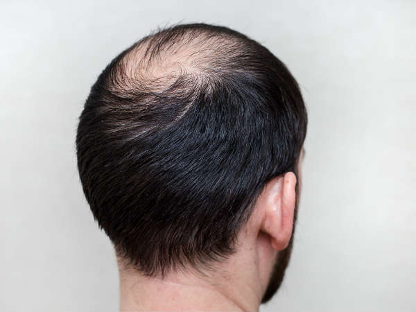  പുതിയ ഉത്പ്പന്നങ്ങളുടെ പരീക്ഷണം