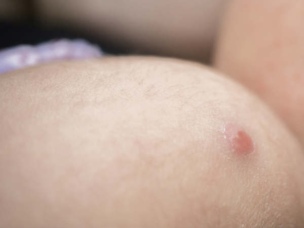 ഇടതു കയ്യുടെ മുകളിലെ തഴമ്പിന്റെ രഹസ്യം 