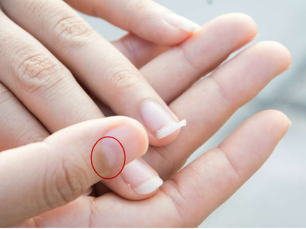 നഖത്തില്‍ ഈ കുഞ്ഞുചന്ദ്രനില്ലെങ്കില്‍,,,