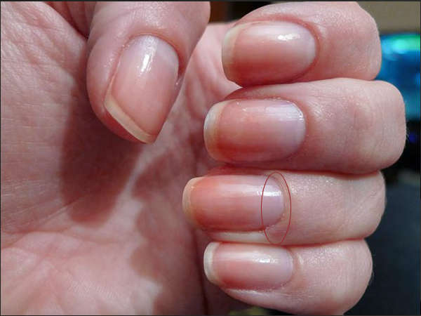 നഖത്തില്‍ ഈ കുഞ്ഞുചന്ദ്രനില്ലെങ്കില്‍,,,