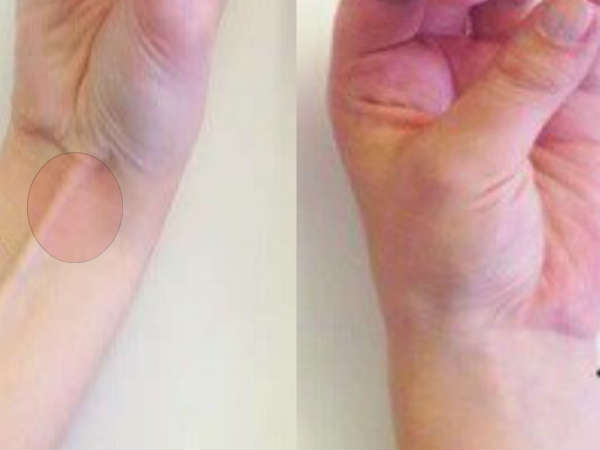  ഇങ്ങനെ പിടിയ്ക്കുമ്പോള്‍ ഞരമ്പു കാണുന്നുവോ?