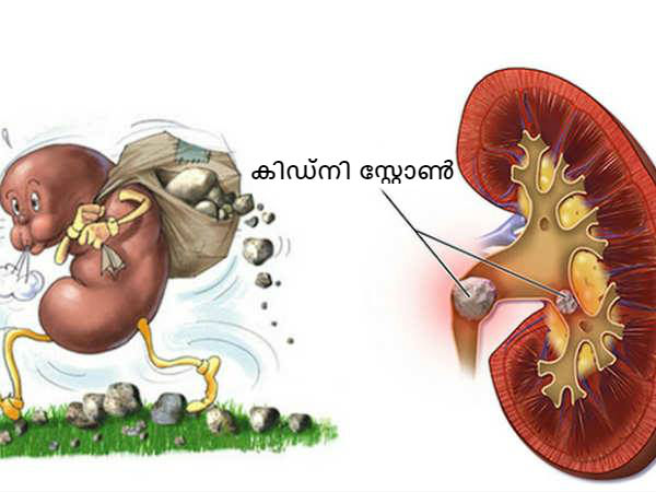 പുരുഷന് മാത്രം