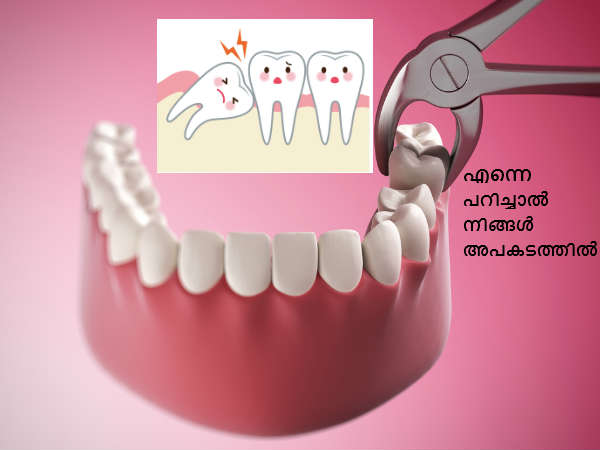 വിസ്ഡം ടൂത്ത് പറിയ്ക്കരുത്, കാരണം.......