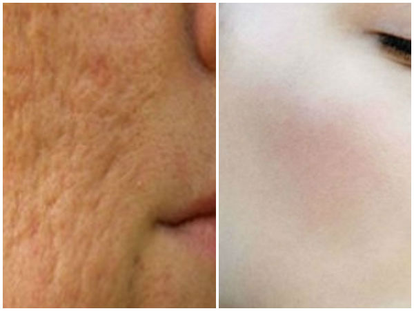  നാരങ്ങയും തേങ്ങാപ്പാലും കരിമ്പും