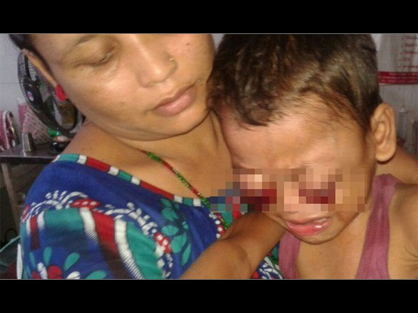 ക്യാന്‍സര്‍ കണ്ണിന്