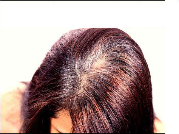  ഗര്‍ഭാവസ്ഥയില്‍ മുടി കളര്‍ചെയ്താല്‍