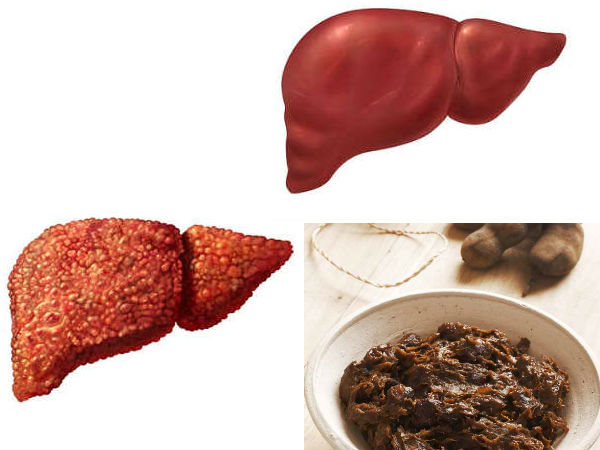 ലക്ഷണങ്ങള്‍